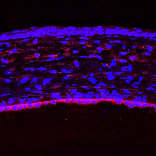 IF of P10 mouse cornea stained with DSHB antibody AFFN-BIRC3-17G5 against BIRC3 (red) and DAPI (blue). Image credit: Lachke Laboratory, University of Delaware.